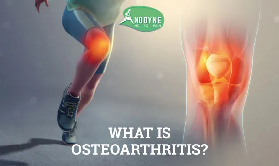 What-is-osteoarthritis.jpg